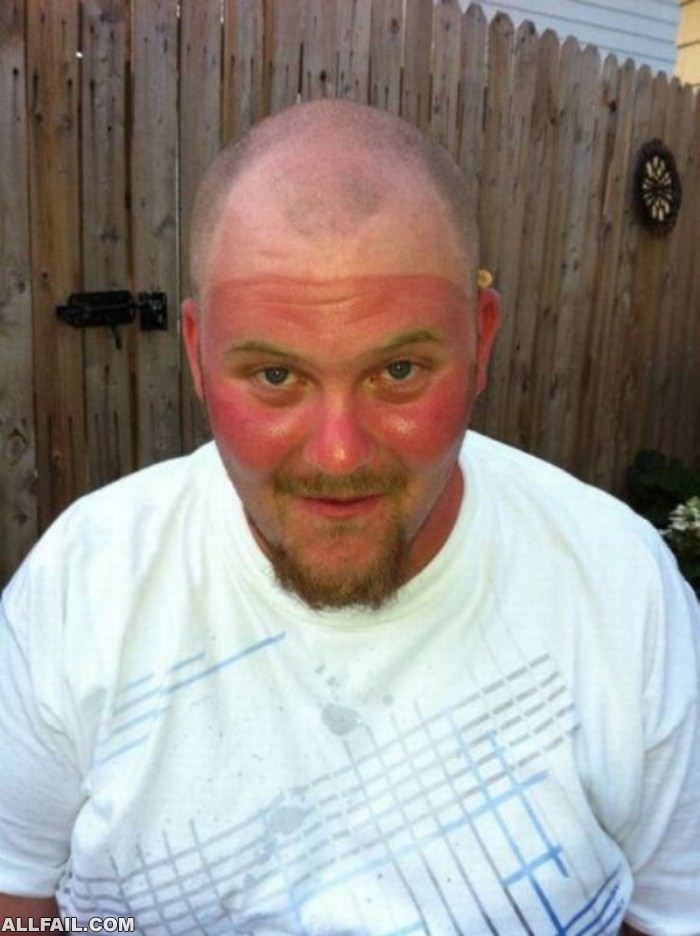 nice burn line